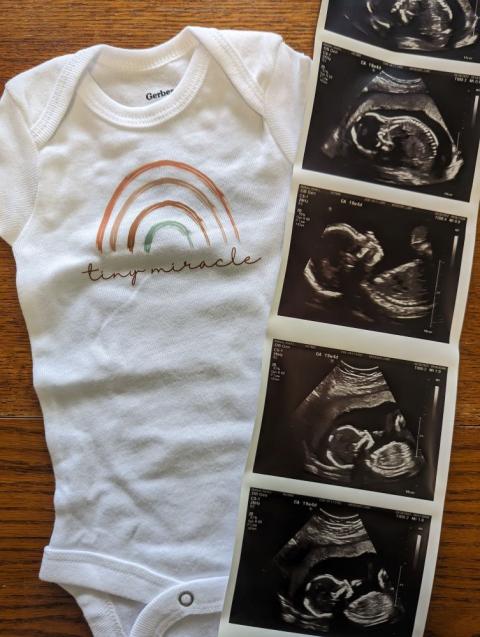 A rainbow onesie and ultrasound pictures of the Mahons' daughter Gracie from April 2023. (Grist/Courtesy of Kirsti Mahon)